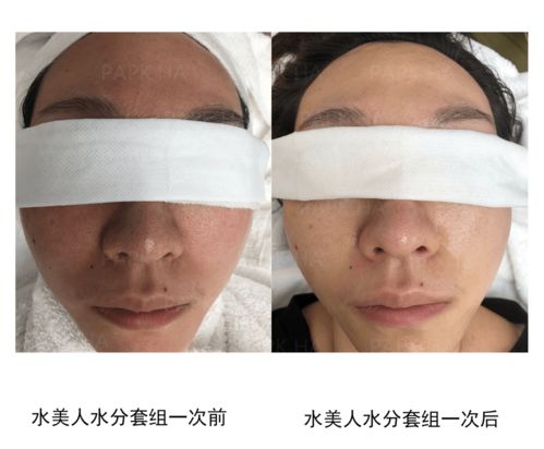 皮膚管理與生活美容 專業差異與生活服務